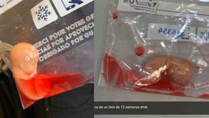 Hazte Oír envía réplicas de fetos ensangrentados a los diputados por la Ley del aborto