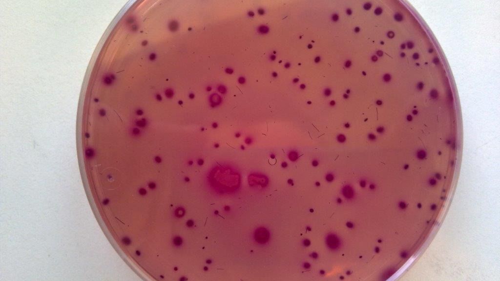 Alarma científica total: detectan por primera vez una bacteria resistente a todos los antibióticos