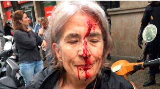 La ONU pide una investigación sobre la violencia en Cataluña