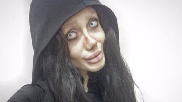 Una chica iraní se opera hasta 50 veces para tener el rostro de Angelina Jolie