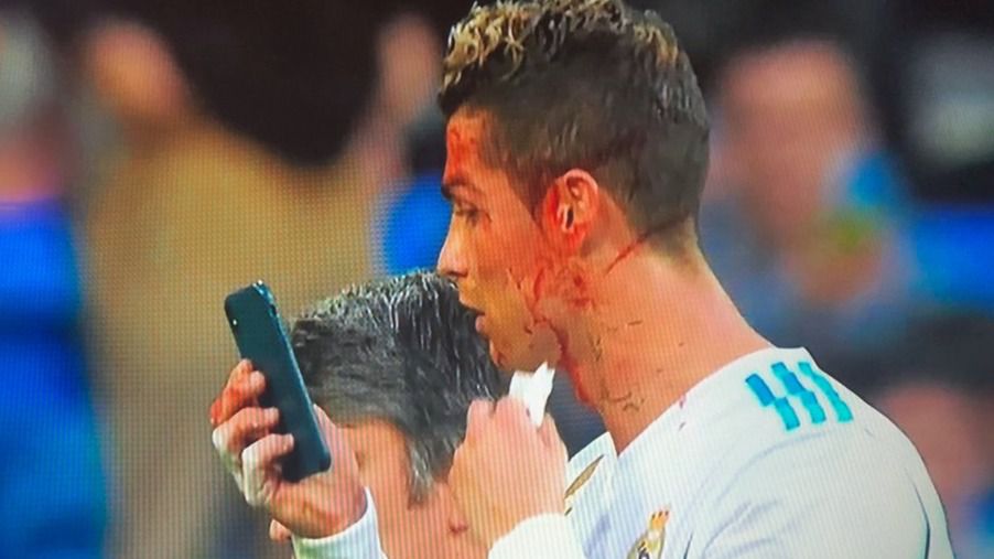 La herida y la sangre de Ronaldo se convierten en carne de debate y memes en Internet