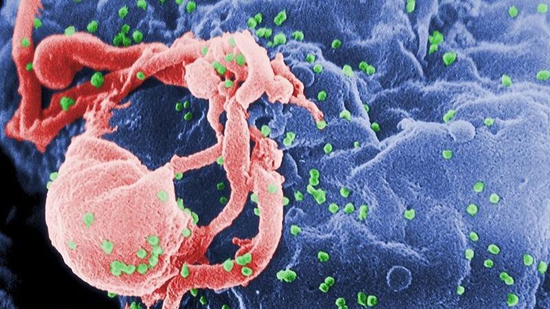 El VIH desaparece en un segundo paciente tratado con células madre