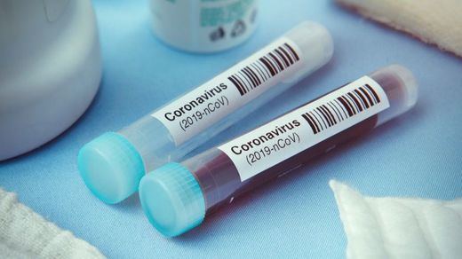 Las farmacéuticas aceleran su lucha contra el coronavirus: hay medicamentos y vacunas en desarrollo
