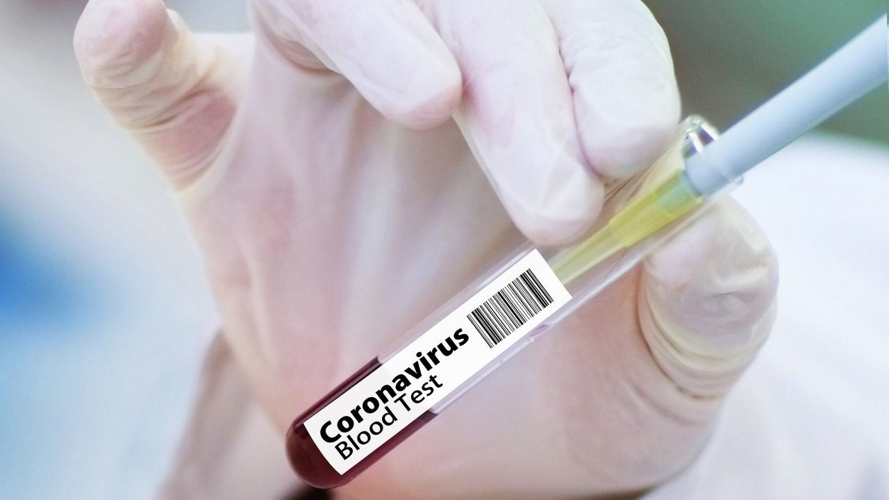 China autoriza pruebas clínicas de 2 vacunas para el coronavirus covid-19