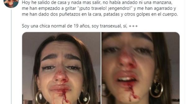 Las redes estallan contra la brutal agresión a una joven trans en Barcelona