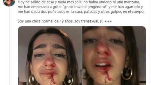 Las redes estallan contra la brutal agresión a una joven trans en Barcelona