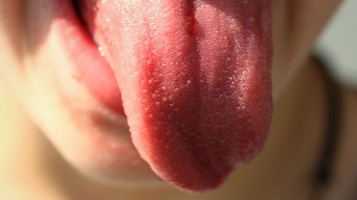 Un estudio español encuentra nuevos síntomas del covid: aumento del tamaño de la lengua y otras lesiones