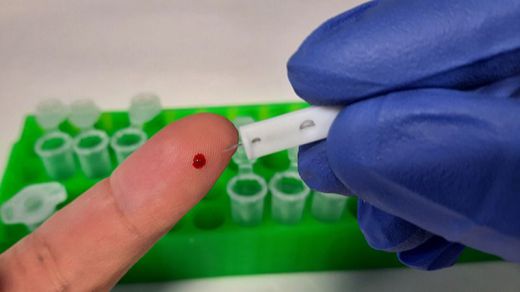 Un test español de coronavirus con un 99% de fiabilidad y capaz de detectar la cantidad de anticuerpos