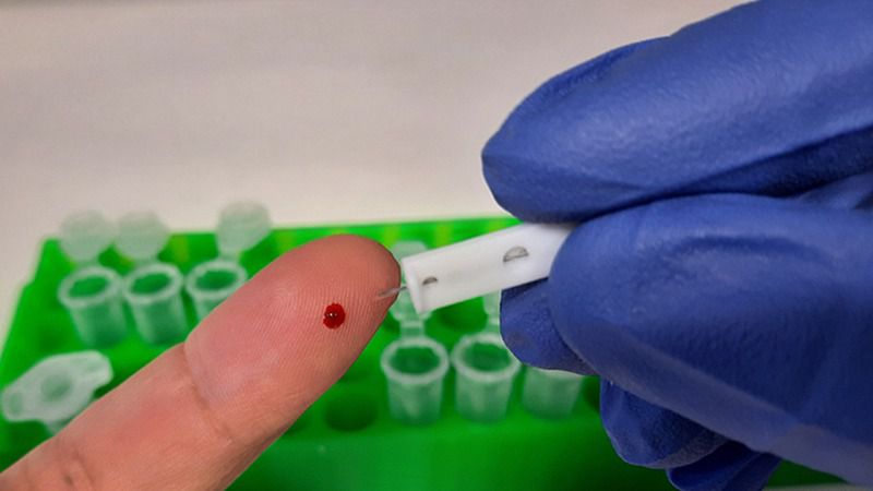 El Gobierno autorizará el próximo martes la venta en farmacias de test de autodiagnóstico sin receta
