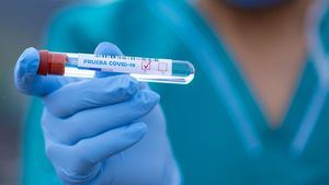 Primer caso en el mundo de 'flurona': tener coronavirus y gripe a la vez