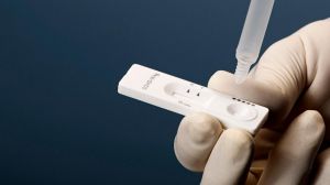 Sanidad fija el precio máximo a la venta para los test de antígenos en 2,94 euros