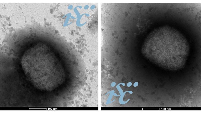 La secuenciación confirma que el virus de la viruela del mono del brote de España es 'el menos maligno'