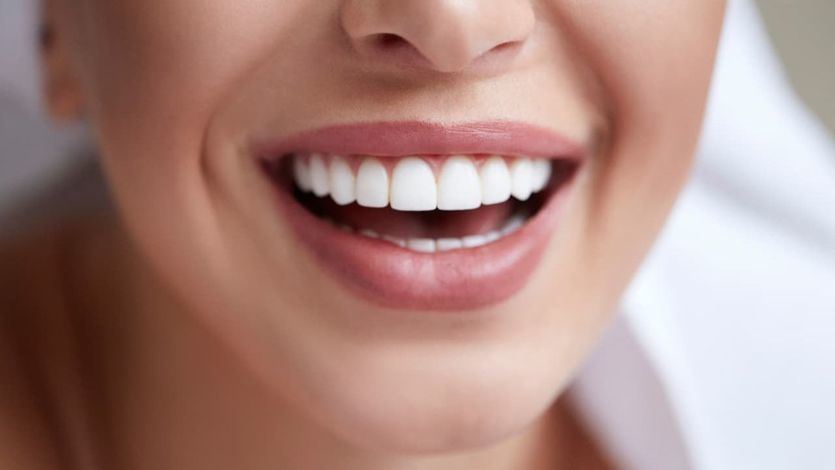 ¿Qué ventajas ofrecen las carillas dentales, el tratamiento dental de los famosos?