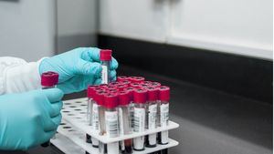 Primera transfusión a humanos de sangre cultivada en laboratorio
