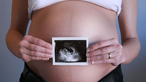 Se aprueba la reforma de la ley del aborto que elimina el consentimiento paterno para las menores de 16 años