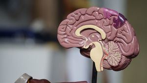 Detectan los primeros casos de transmisión del alzhéimer: con una hormona extraída de cadáveres