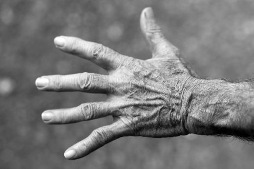 Descubren un posible origen de la artritis reumatoide