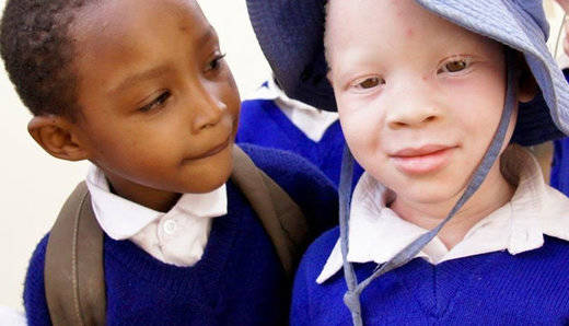 El 'Proyecto Albinos de Tanzania' gana un Premio Excellens