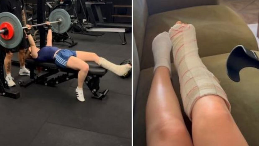 La influencer Roro entrenando con una fractura