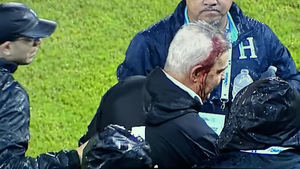 La imagen de la vergüenza del fútbol mundial: abren la cabeza a Javier Aguirre