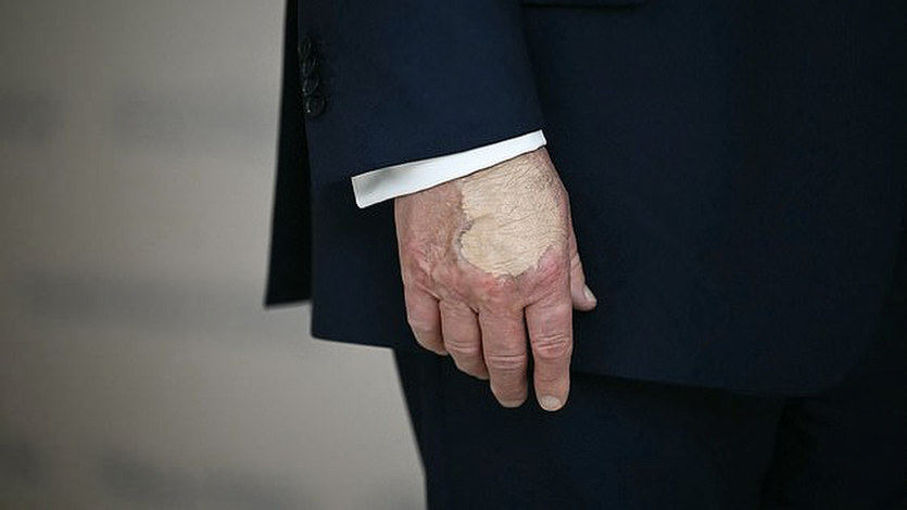 Mano de Donald Trump, presidente de EEUU