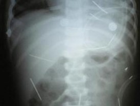 La declaración de Camps