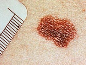 Rosales rechazó uso de recursos del Estado en campaña del Sí