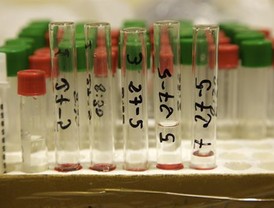 Expertos de la UHU diseñan un pudin terapéutico para enfermos de disfagia