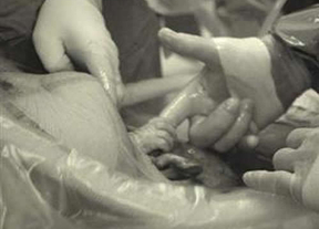 La foto que está arrasando en todo el planeta: el bebé coge la mano del médico desde el útero