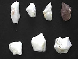 Según un estudio ocho de cada diez fumadoras no abandona el tabaco durante el embarazo