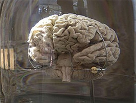 El cerebro decide 200 milisegundos antes de que lo sepa el individuo