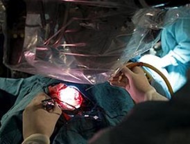 La joya que Extremoduro se tenía guardada