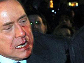 Pajín 'tira' del pasado para defender el 'tijeretazo' de Zapatero