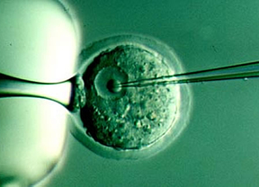 Avance científico, pavor religioso: clonan por primera vez células madre humanas  