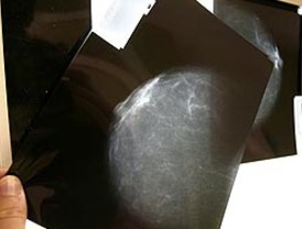 El Ibex 'lidera' el desplome de las bolsas europeas bajando de los 10.000 puntos