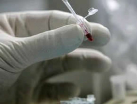 Evo enfermo es obligado a reposar