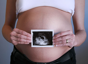 ¿Efecto Gallardón?: los abortos descendieron un 3,2% en 2013, cuando la reforma estaba en marcha