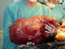 Amparo Larrañaga, en el Gayarre