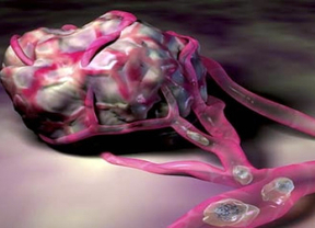 Algo de ilusión: una prometedora molécula ayuda al sistema inmune a luchar contra el cáncer