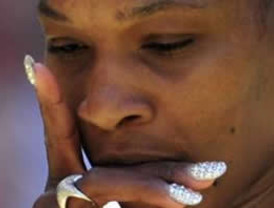 Im-presentables del miércoles, 4 de marzo de 2010