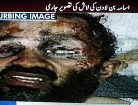 EE.UU. aprueba la primera vacuna para bebés contra la meningitis fulminante