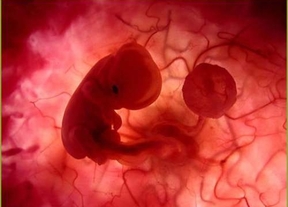 La guerra de las cifras, también en el aborto: ¿aumento o contención?