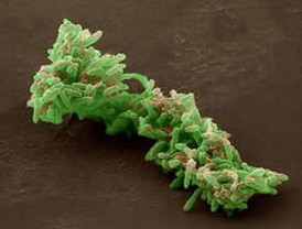 Padres y Madres Divorciados lamenta que CGPJ quiera 'callar' al juez Serrano y elevará una denuncia al Defensor