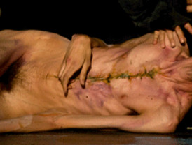 La recuperación de Cascos