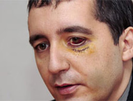 Valduero con la Fundación Vicente Ferrer