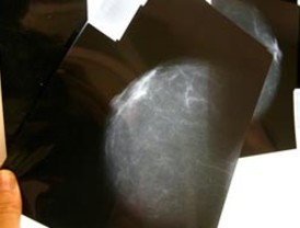 Foro Penal condenó fallo contra ex comisarios