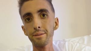 Muere Xisco Quesada, el influencer de 28 años que visibilizó el cáncer de páncreas