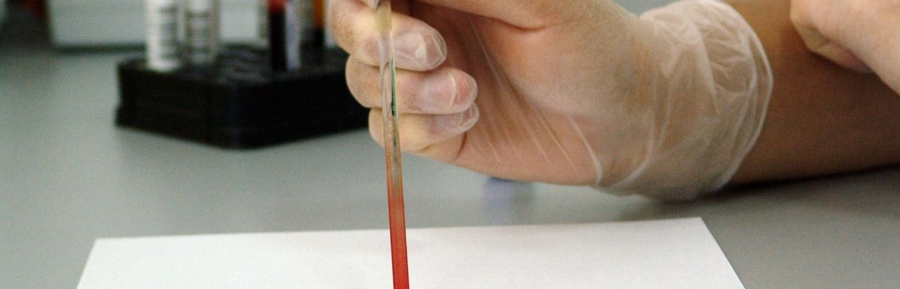 Prueba de laboratorio