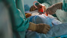 La sanidad pública madrileña, pionera en tratar con éxito miomas a mujeres